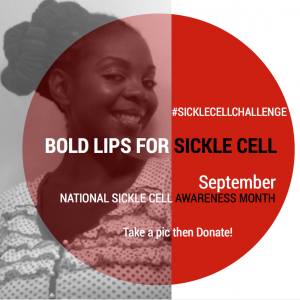 Bold Lips for Sickle Cell