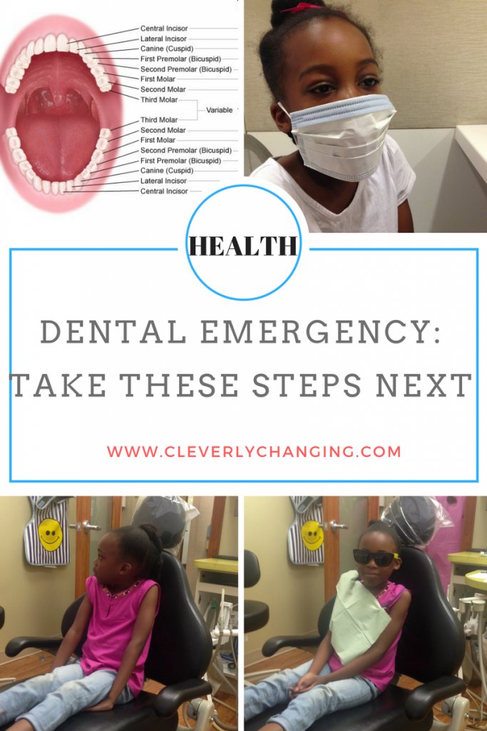 Dental emergency steps