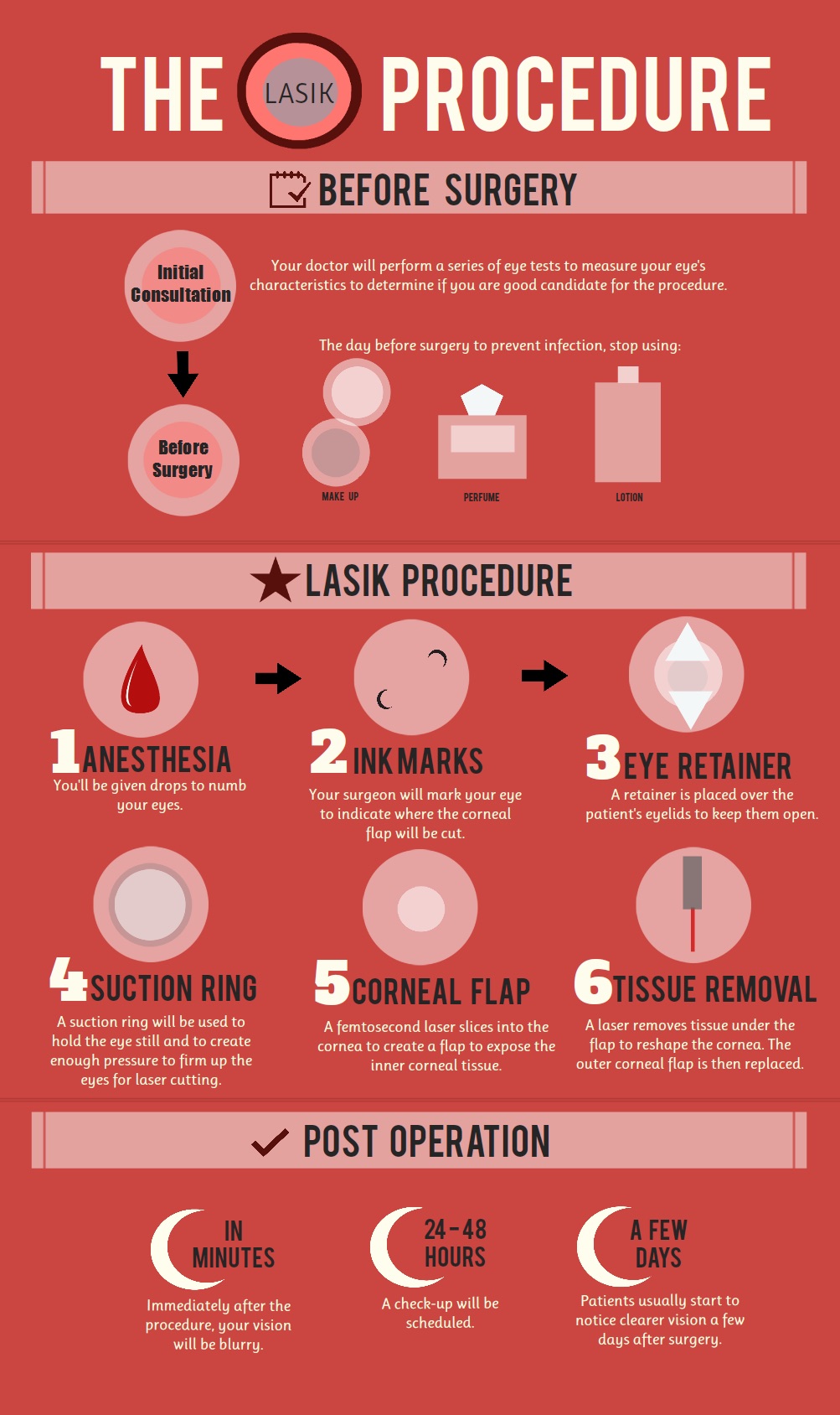 lasik eye surgery procedure guide