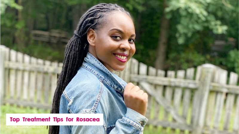Top Treatment Tips for Rosacea | African American Blogger Elle Cole